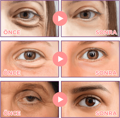 Bellia™ MicroGlow Göz Altı Bandı